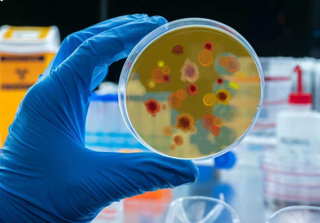 Analize bacteriologie