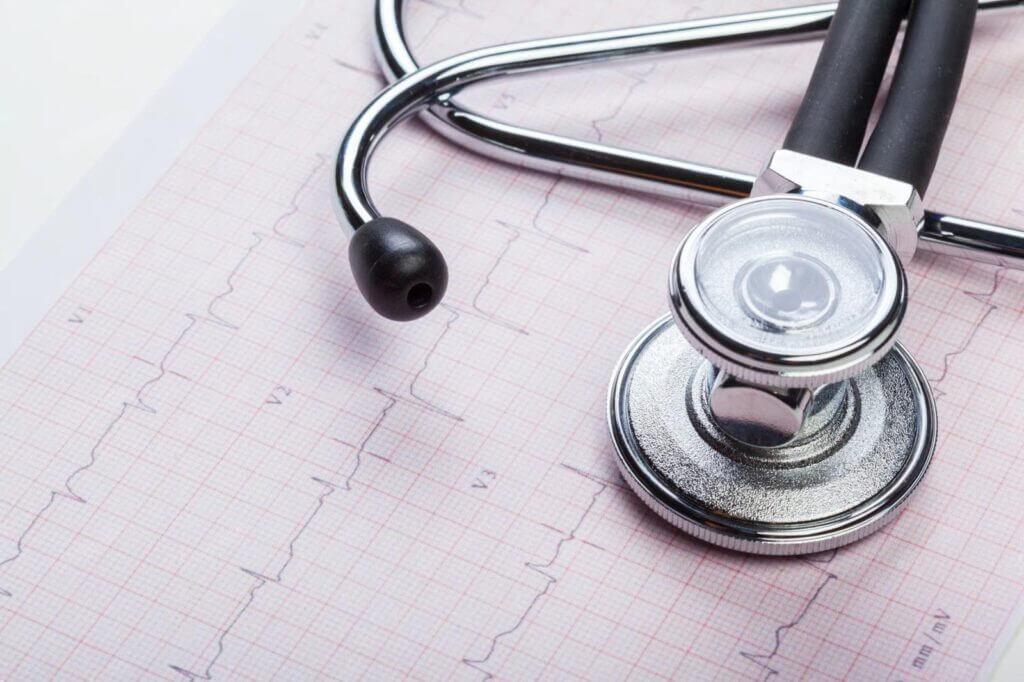 Ekg