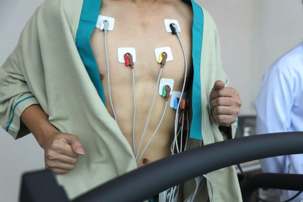 Ekg de efort