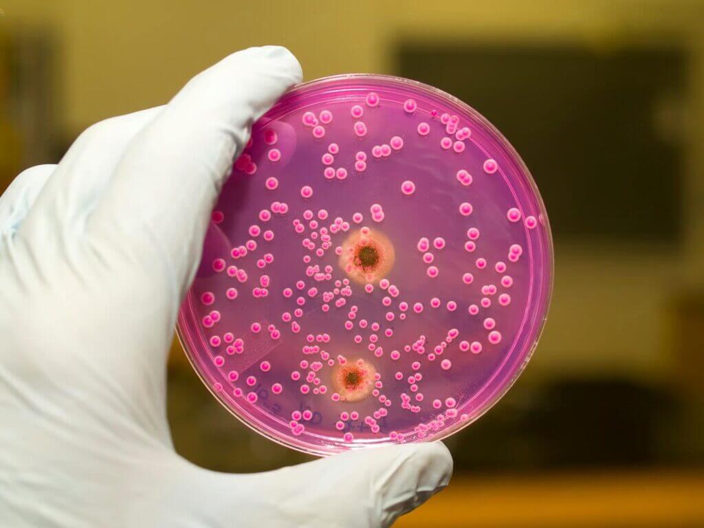 Boli infecțioase